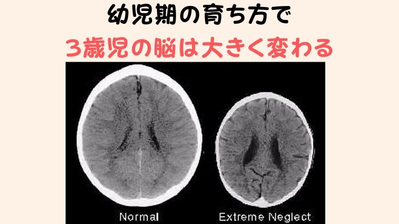 育ち方で違う脳の大きさ